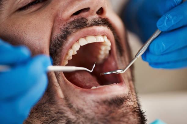 Best Emergency Treatment for Oral Infections in Holland, OH